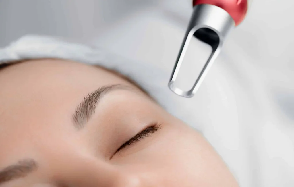 laser treatment for beginners